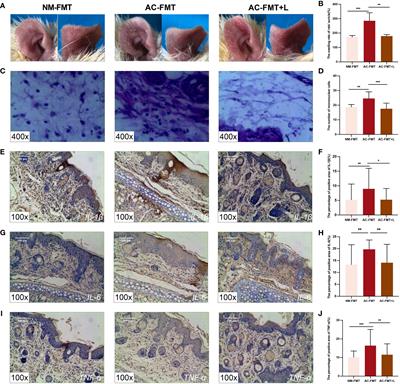 Lactobacillus rhamnosus ameliorates acne vulgaris in SD rats via changes in gut microbiota and associated tryptophan metabolism